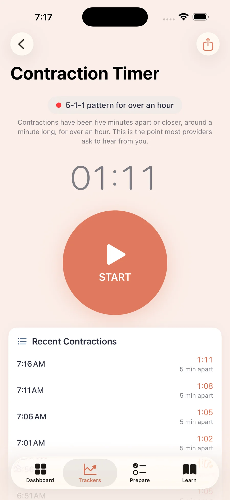 Contraction timer showing a detected 5-1-1 pattern with a list of recent contractions five minutes apart